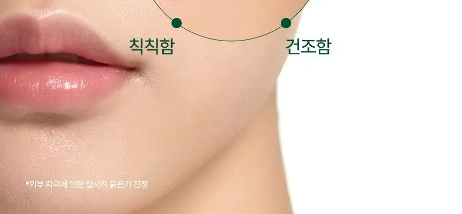 [NEW/쿨링진정] 닥터지 레드 블레미쉬 쿨 수딩 젤리 미스트 100ml 상세페이지 24
